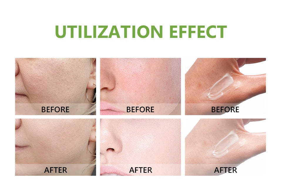 Bubbles Skin care Moisturizing Face Cream Bubbles Moistruizer Niacinist Beauty and Personal Care Skin Whitening Cream Original