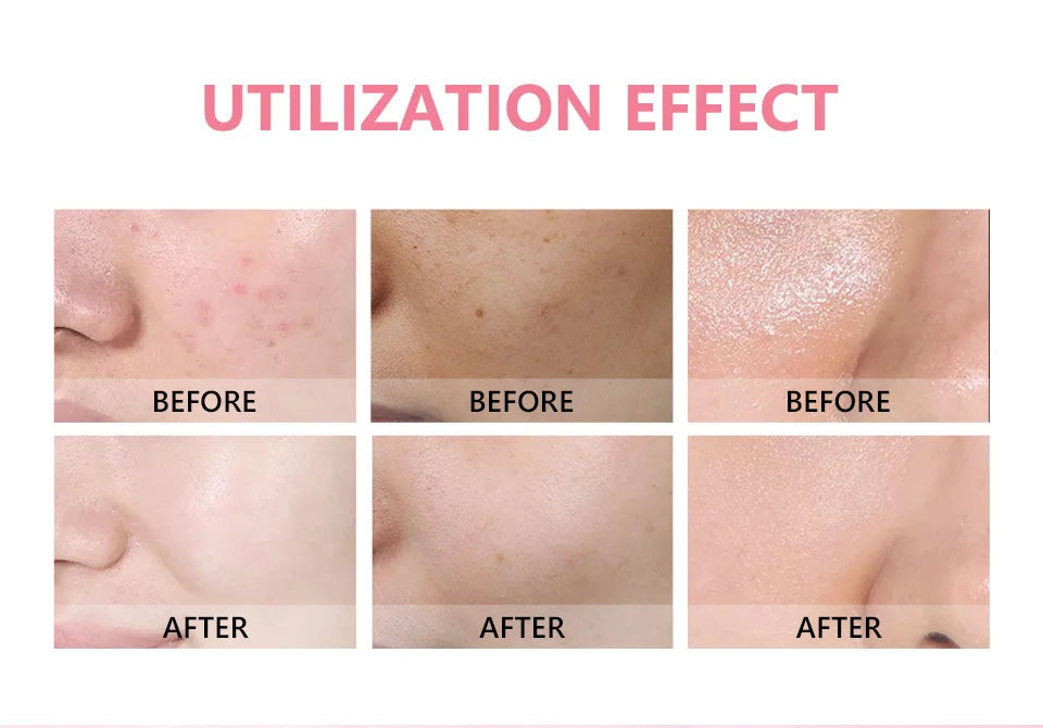 Bubbles Skin care Moisturizing Face Cream Bubbles Moistruizer Niacinist Beauty and Personal Care Skin Whitening Cream Original